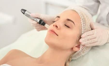 Microneedling